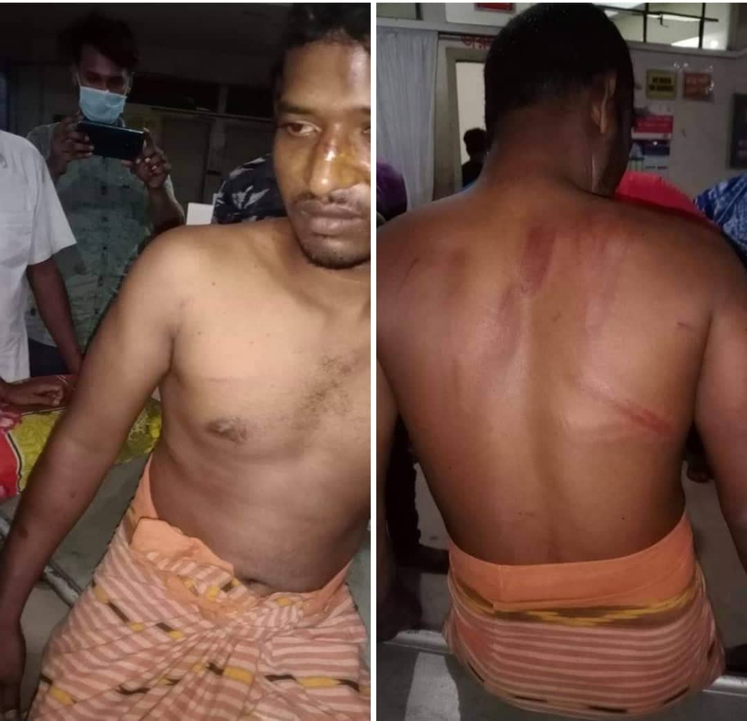 চাঁপাইনবাবগঞ্জের কানসাট-গোমস্থাপুর সড়কে আবারও ডাকাতি।। রেহাই পেলোনা গরীব ভ্যান চালক