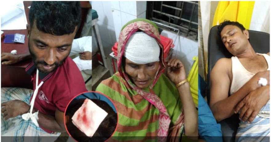 কক্সবাজারের উখিয়ায় শালিশী বৈঠকে সন্ত্রাসী হামলায় আওয়ামী পরিবারের ১০ জন আহত।। গাড়ি ভাংচুর