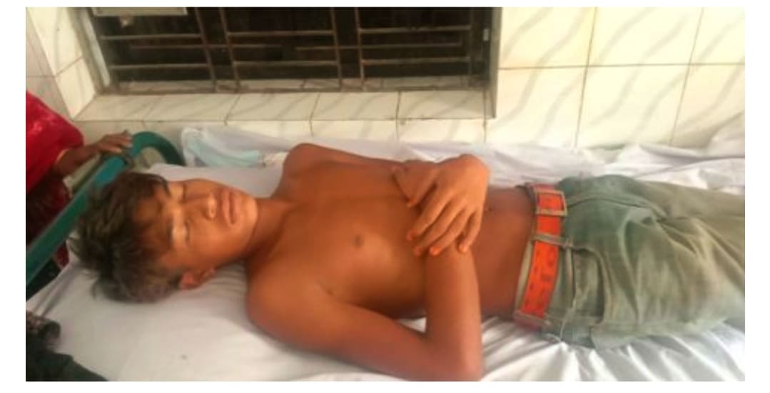 চাঁপাইনবাবগঞ্জের নাচোলে এক পাষন্ডের পিটুনিতে কিশোর আসাদুল রাজশাহী মেডিকেল ভর্তি