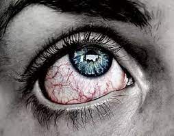 রাজধানীর বারডেম হাসপাতালে ব্ল্যাক ফাঙ্গাসে একজনের মৃত্যু