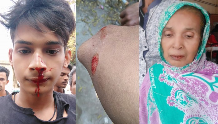 মহানগরীতে প্রতিপক্ষের হামলায় মা ও দাদিসহ একই পরিবারের ৫ সদস্য আহত