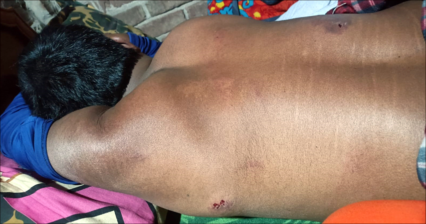 চাঁপাইনবাবগঞ্জে করোনার টিকা নিতে এসে ইভটিজিংয়ের শিকার শিক্ষার্থীরা