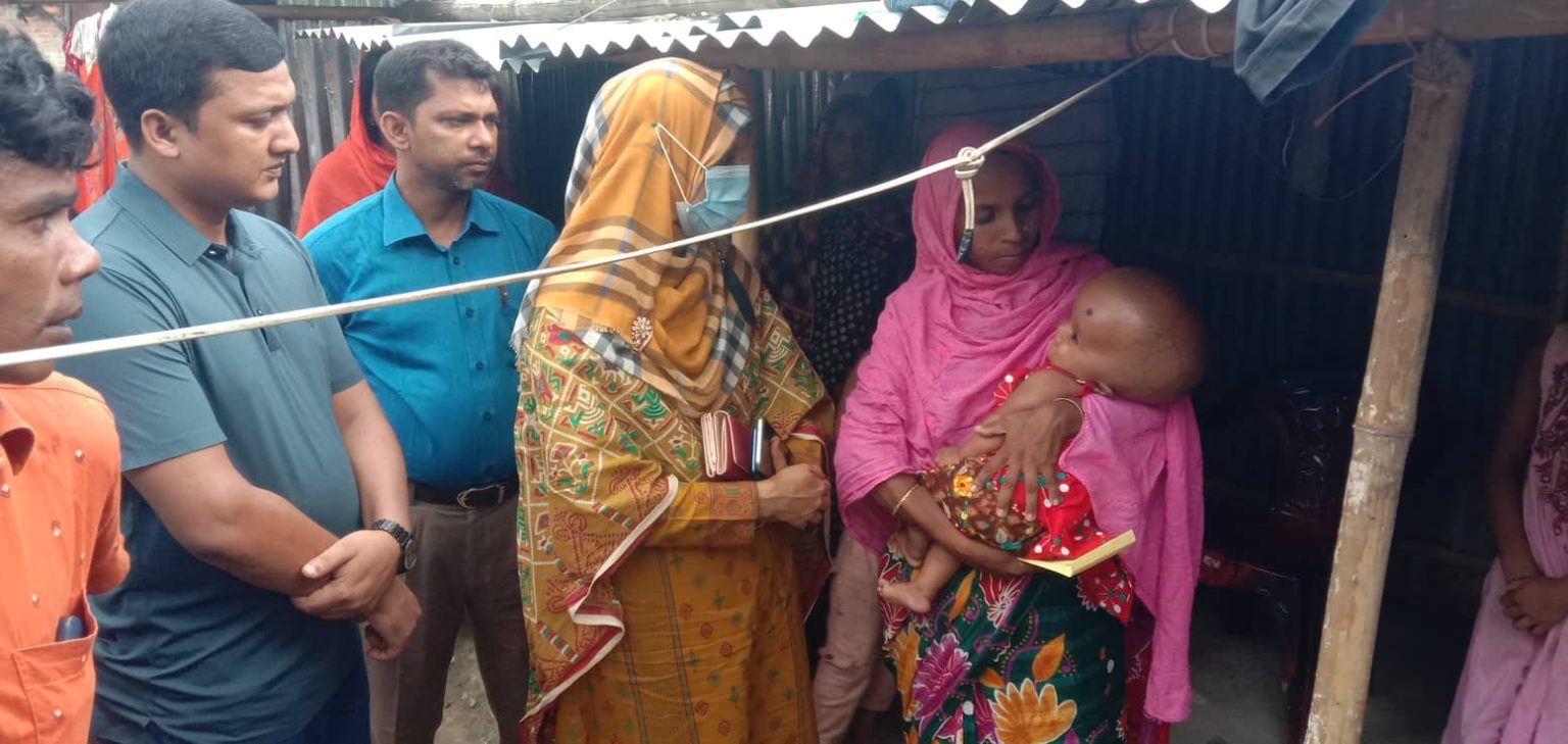 গোমস্তাপুরে বিরল রোগে আক্রান্ত শিশু আম্বিয়ার চিকিৎসার খোঁজ নিলেন ইউএনও