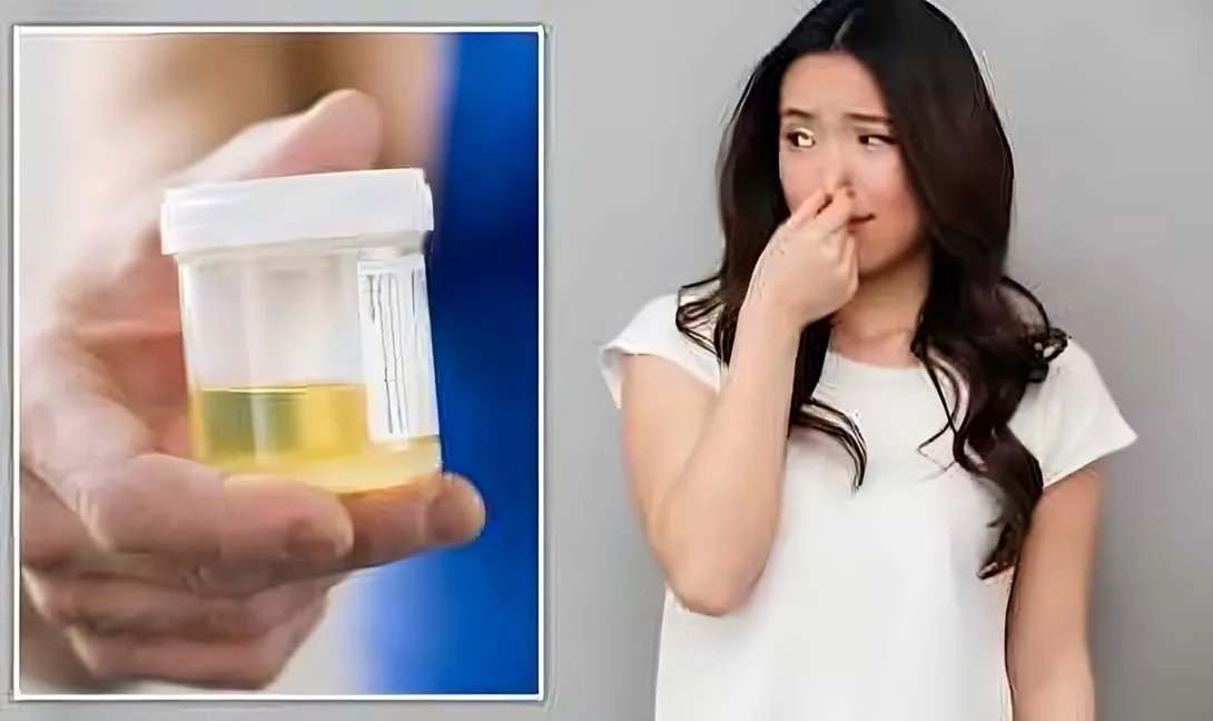 সাধারণত প্রস্রাব গন্ধহীন,মাত্রাতিরিক্ত দুর্গন্ধ যেসব রোগের লক্ষণ